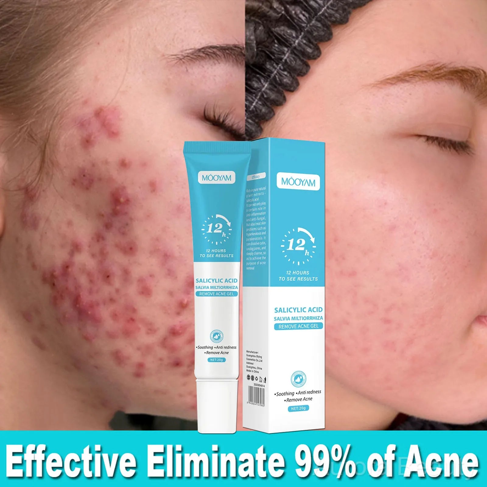 Acne Cream Face Pimples Remover