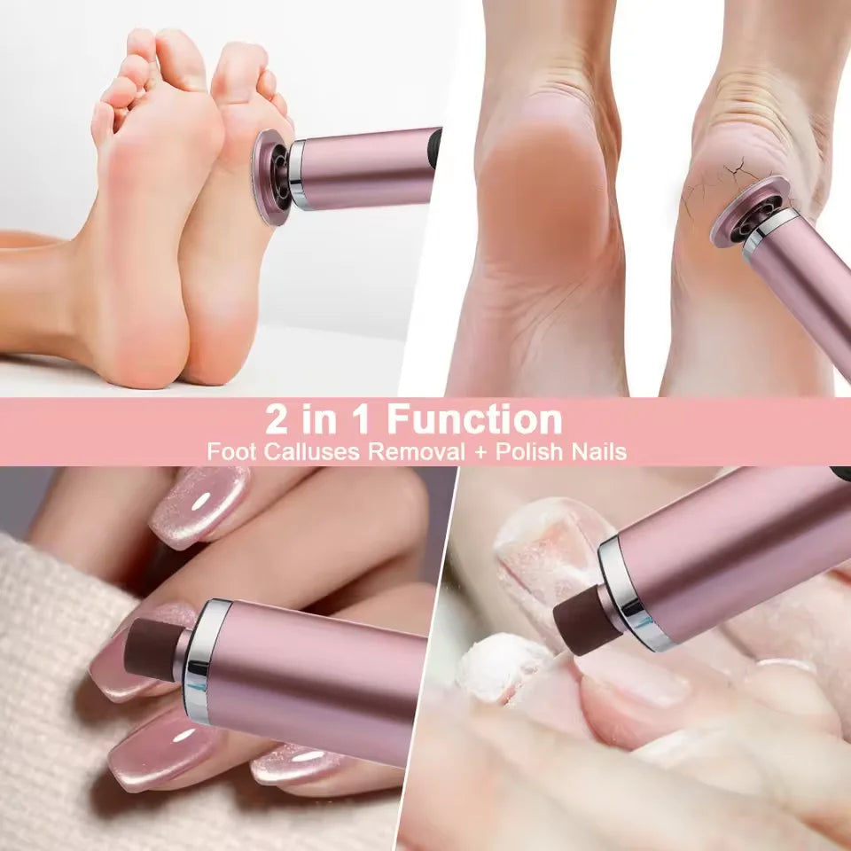 Wireless Electric Foot Callus Remover