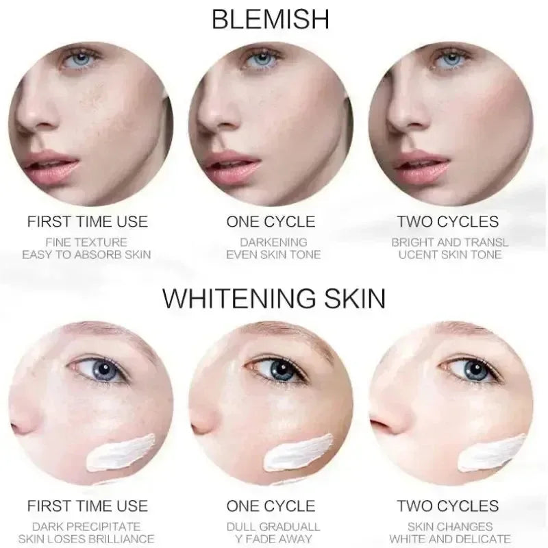1/3/5pcs Whitening Freckle Cream