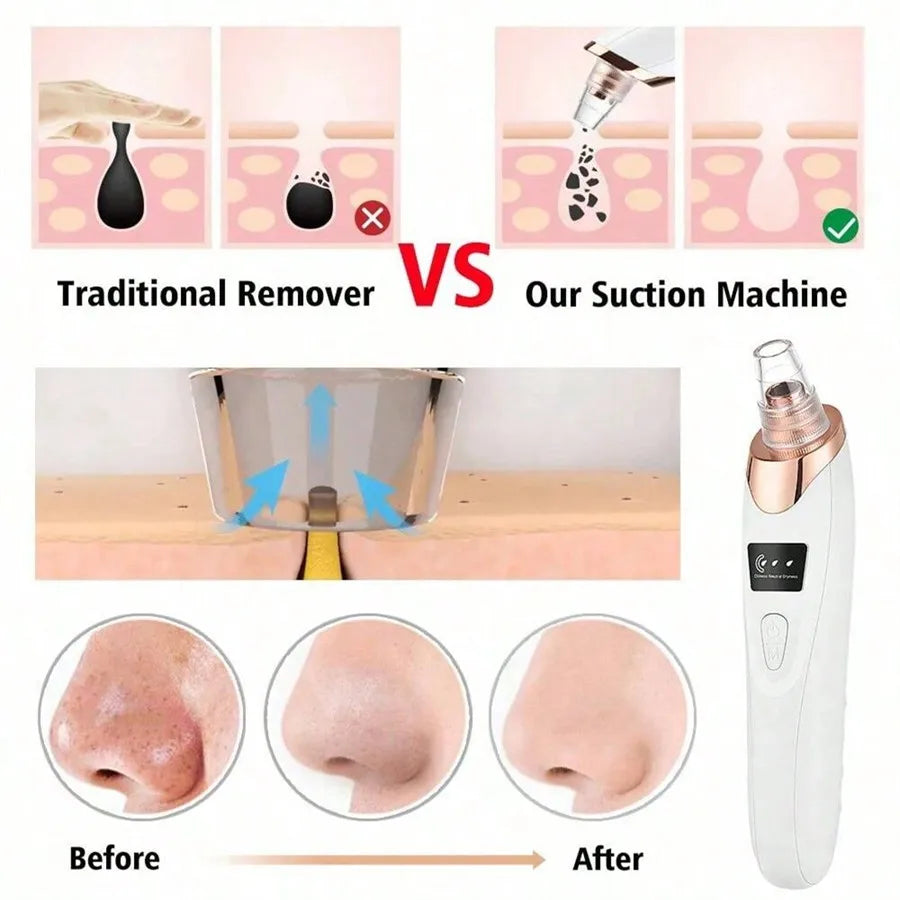 Women Blackhead Remover Pore Vacuum